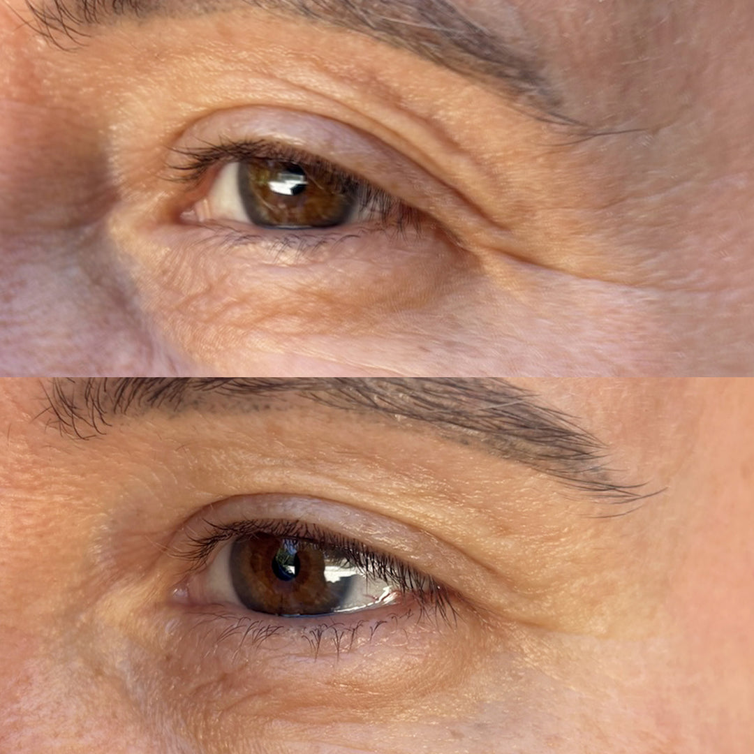 J-0