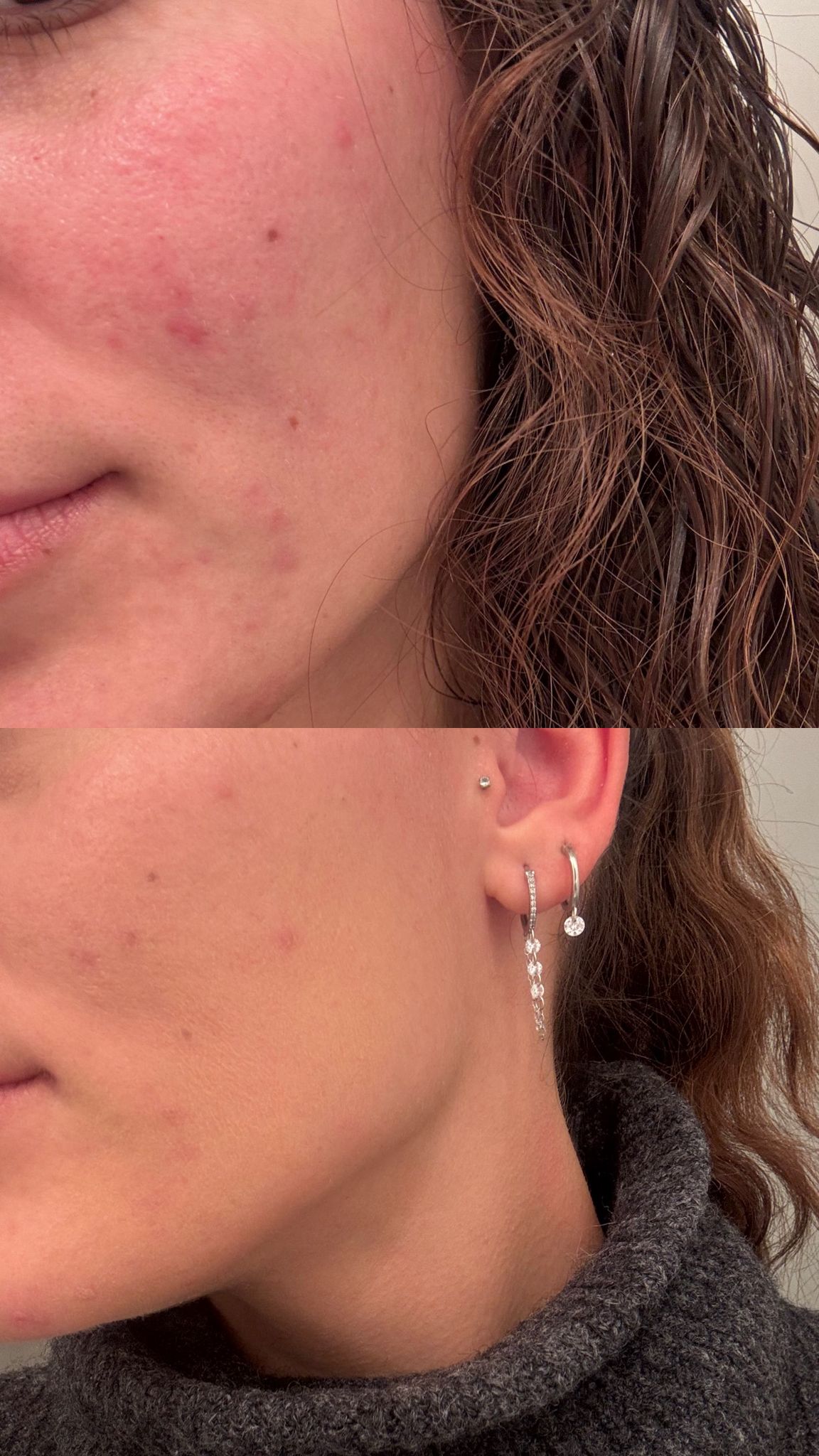 AVANT/APRÈS EN 28 JOURS